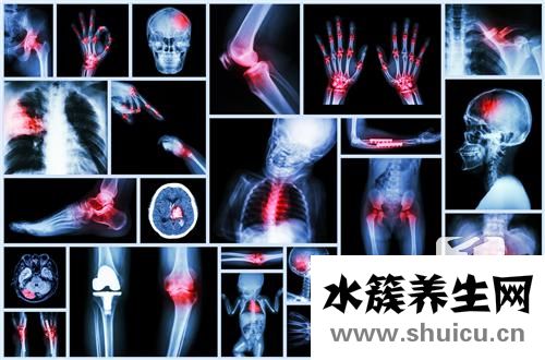 骨裂和骨折的區(qū)別