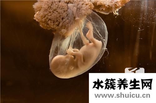 雙側腎盂無分離