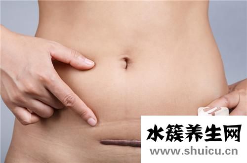 高齡產婦的危險