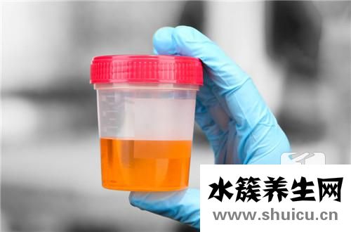 酮體弱陽(yáng)性