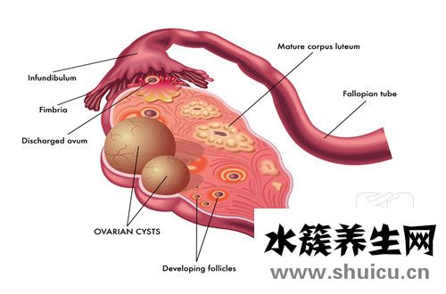 輸卵管堵塞手術(shù)
