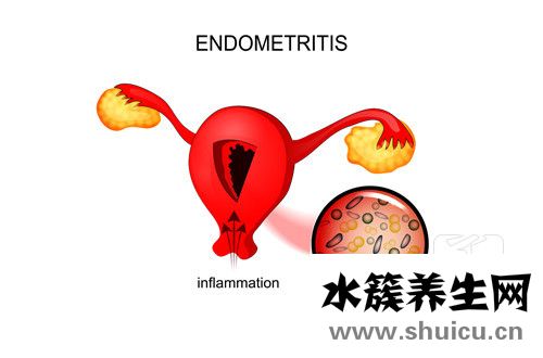 宮腔鏡手術需要住院嗎
