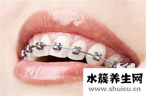 帶牙套可以改變臉型嗎