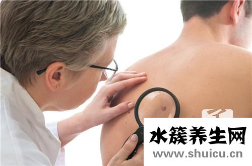 激光點(diǎn)痣正常恢復(fù)過程