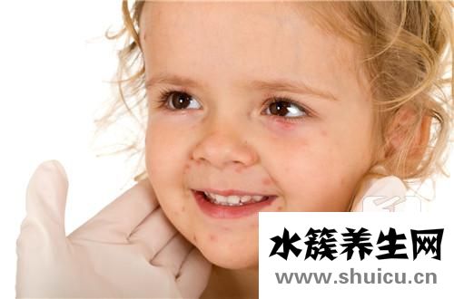 臉上小包不痛不癢凸起