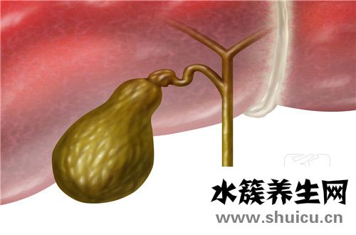 膽摘除有什么影響