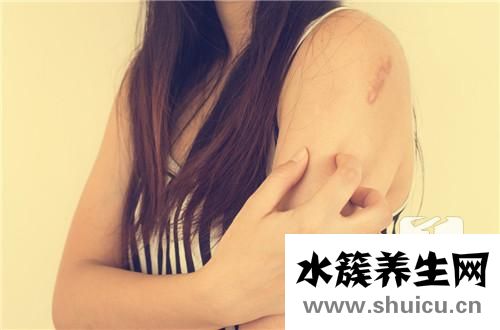 帶狀皰疹前期癥狀