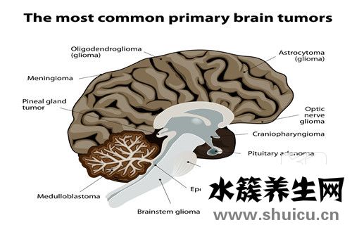 神經纖維瘤能治好嗎