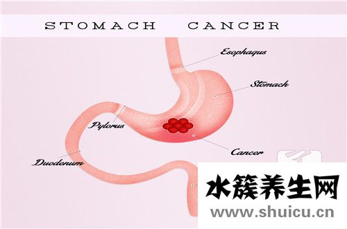 急性腸胃炎幾天能好