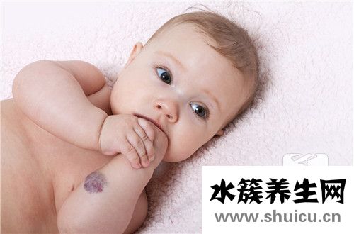 顱內海綿狀血管瘤