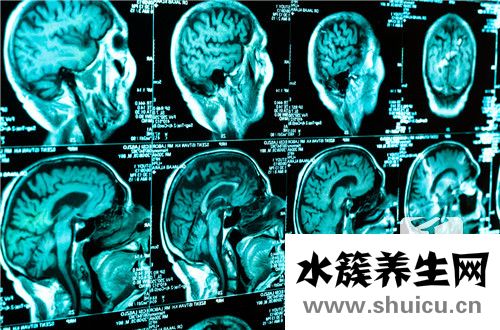 后腦勺疼快速緩解