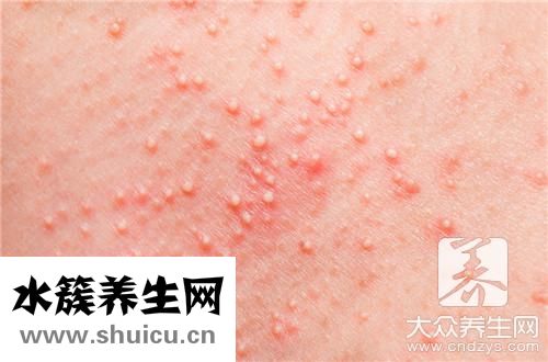 過敏能喝牛奶嗎