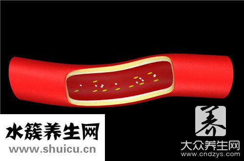 主動脈及冠狀動脈鈣化