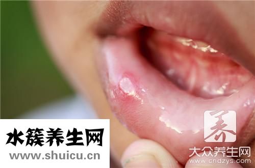 口腔兩側有白斑同