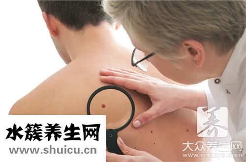 膠質(zhì)瘤能治好嗎