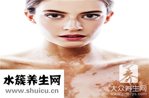 紫癜早期癥狀同