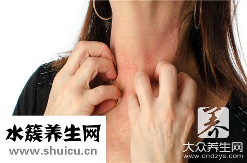 神經(jīng)性皮炎形成原因