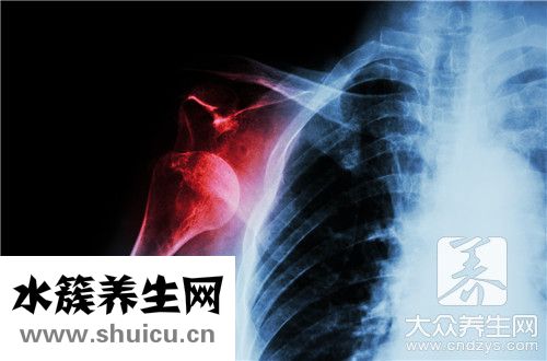 關節鏡手術恢復要一年