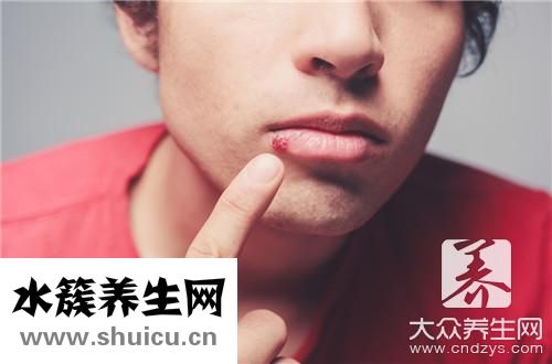 嘴起泡了快速消