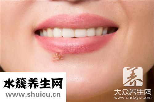 嘴起泡了快速消