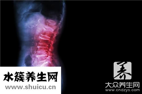 強直性脊柱炎一般壽命