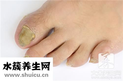 指甲里面有淤血