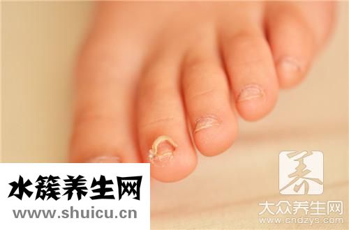 指甲里面有淤血