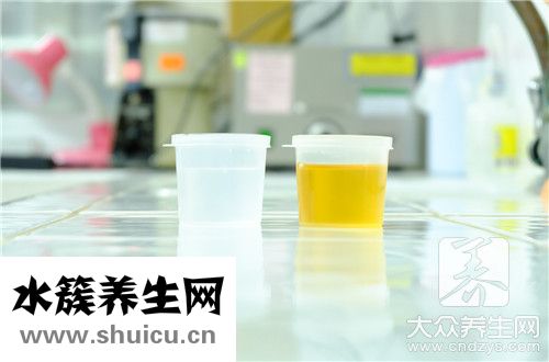 泡沫尿多久消失算正常