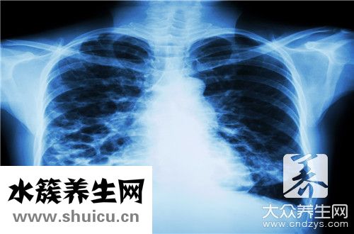 肺部毛玻璃結(jié)節(jié)