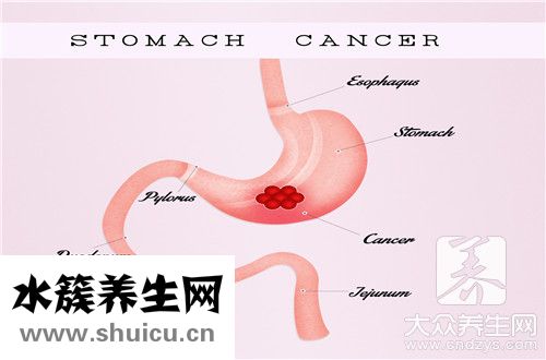 非萎縮性胃炎吃什么藥