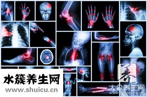 第五跖骨骨折走路早了