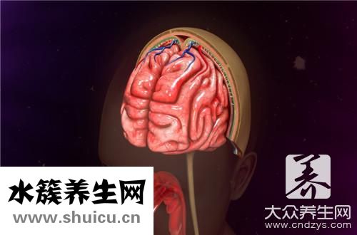 腦血管檢查最佳方法