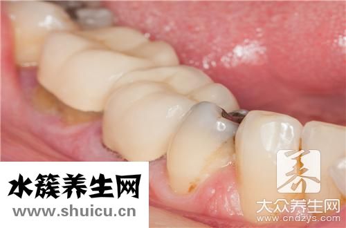 抽煙牙齒變黑辦