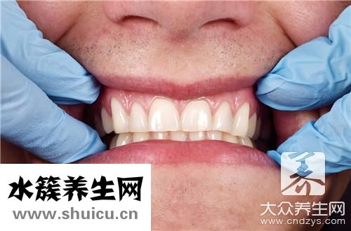 門牙往外突矯正小竅門