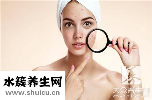 下巴老是長痘痘