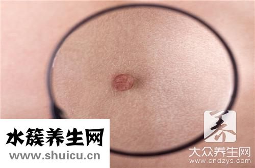 又紅又硬一按就痛痘痘