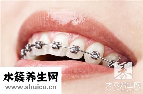 全烤瓷牙套價格