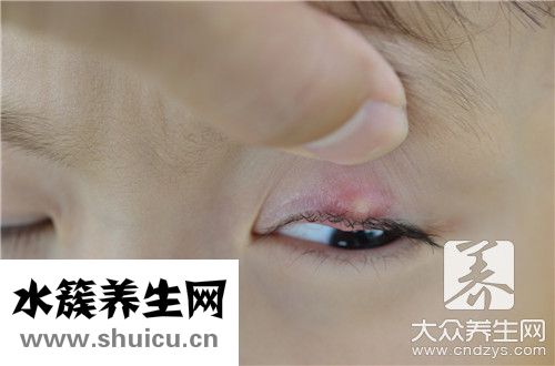 去黑眼圈小妙招