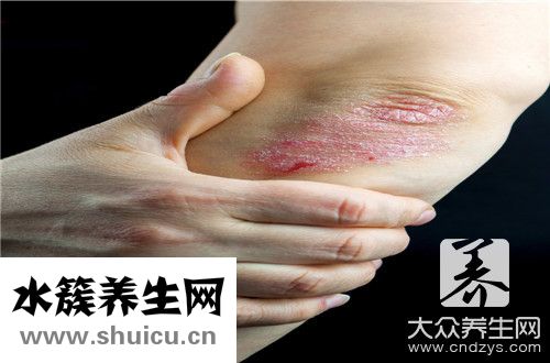 銀霄病是什么引起