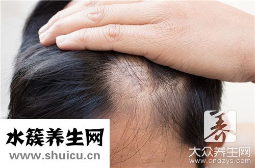 氣血不足掉發辦