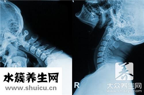 頸椎病會引起胸痛嗎