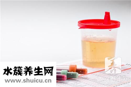 正常尿液泡沫同