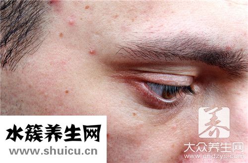 頭上長(zhǎng)包是回事