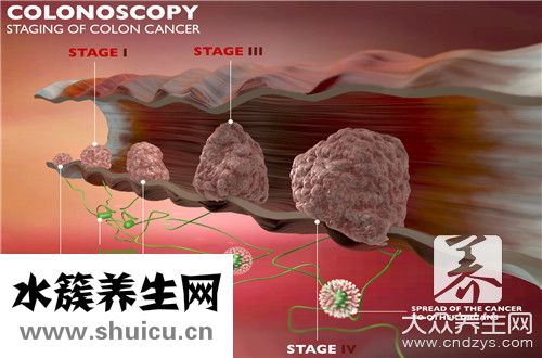 多少熱量等于一斤脂肪