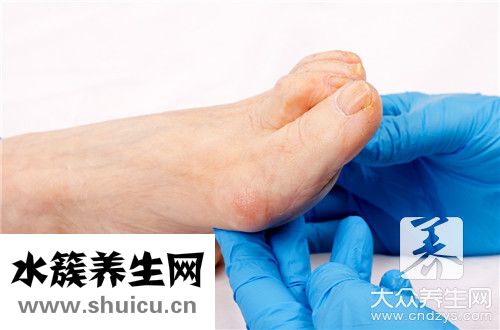 腳容易出汗是什么原因