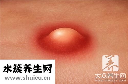 毛孔粗大用什么護(hù)膚品