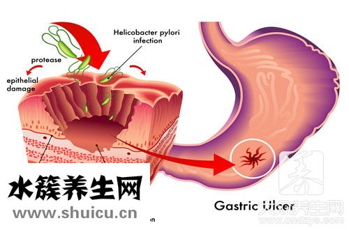 腸胃不好調(diào)理食譜