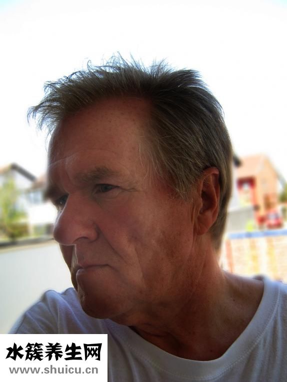 無緣無故流鼻血