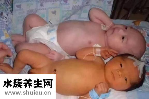 嬰兒黃疸怎么處理