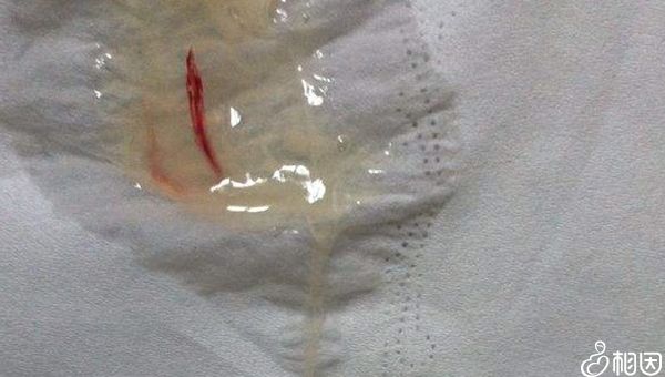 著床成功排出白帶圖片，乳房哪種疼是懷孕了